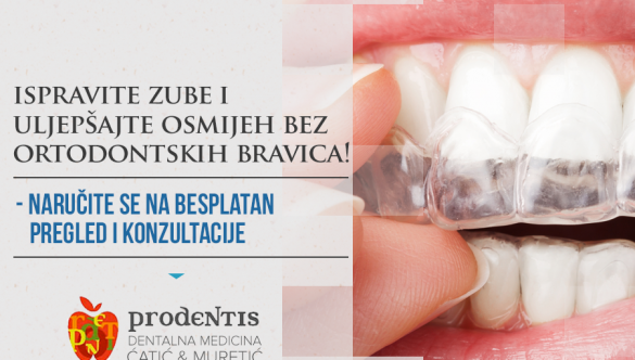 Želite ispraviti zube i uljepšati osmijeh a ne želite ortodontske bravice?